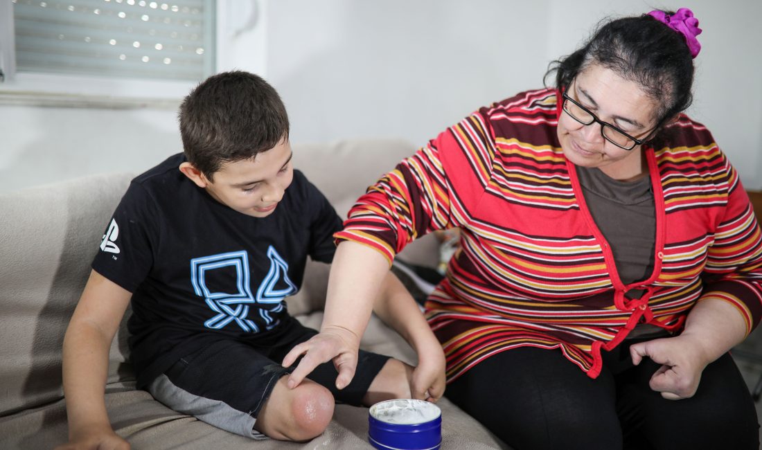 Antalya'da el ve ayak anomalisiyle dünyaya gelen, bu nedenle bacakları